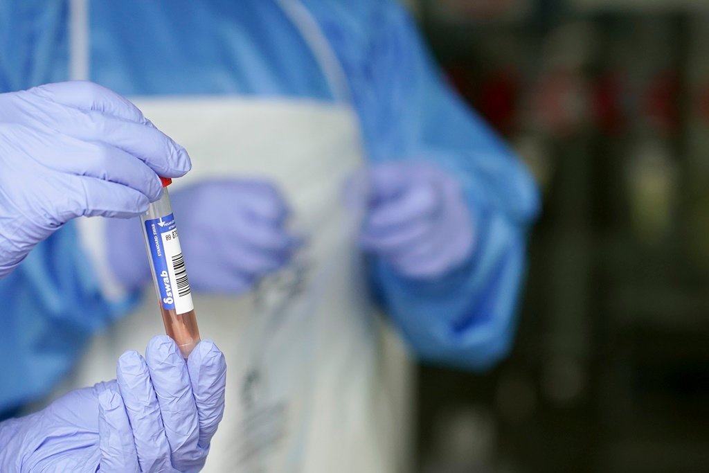 Un sanitario sostén unha mostra para realizar unha análise PCR (Europa Press).