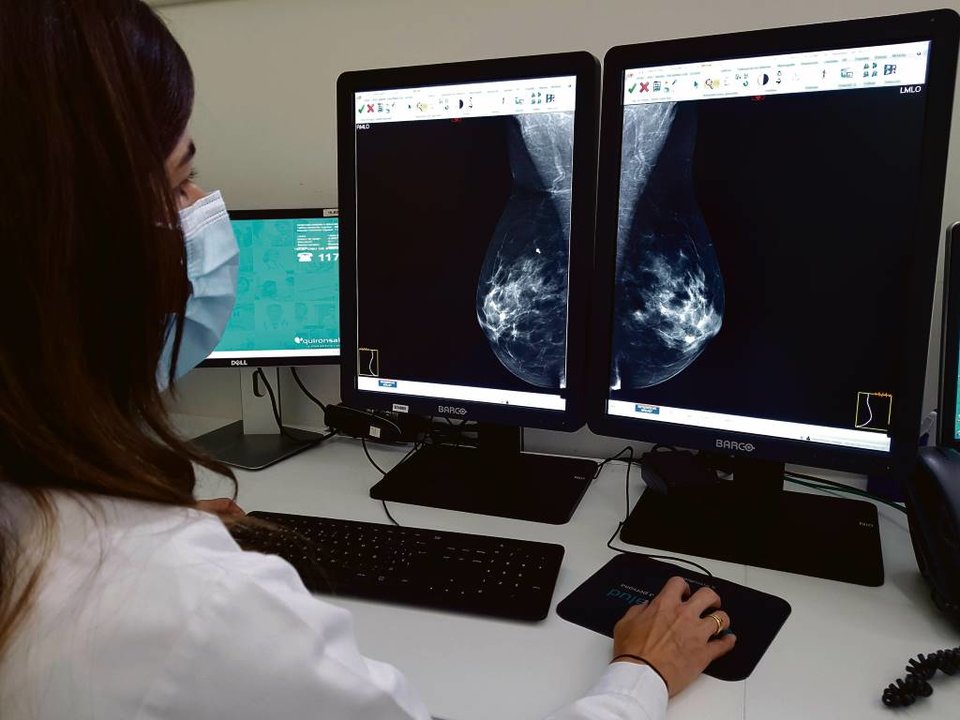 Imaxe dunha mamografía para detectar o cancro de mama (Imaxe: Europa Press)