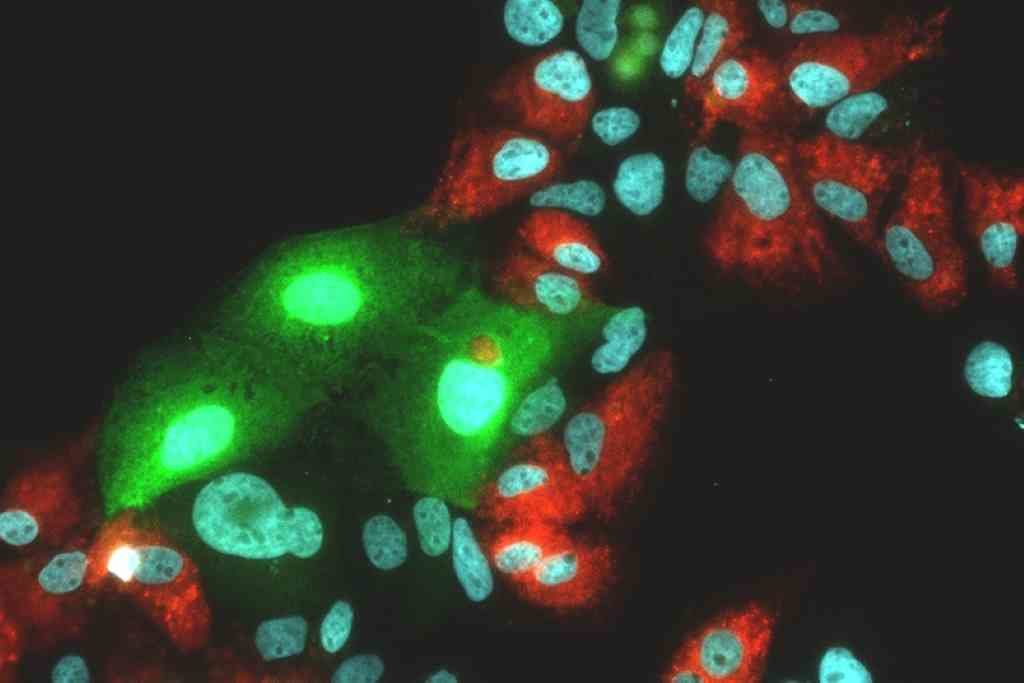 Imaxe tomada con microscopio do virus da hepatite. (Foto: Europa Press)