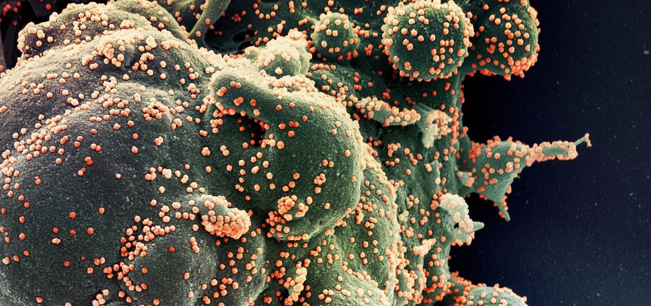 ​Micrografía electrónica de coronavirus SARS-CoV-2 enfectando célula (NIAID-NIH)