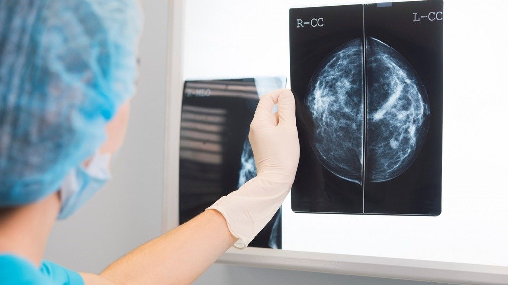 A comunidade experta advirte dun aumento de 10% na mortalidade entre as doentes con cancro de mama e de 15% con cancro colorreital.
