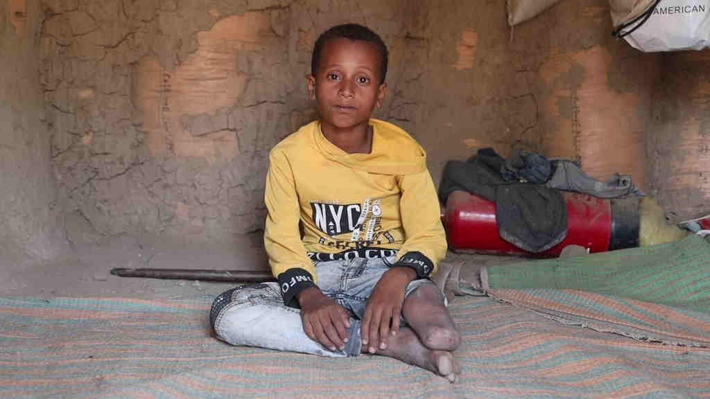 Crianza refuxiada no Iemen. (Foto: Al Baraa Mansoor / Save the Children)