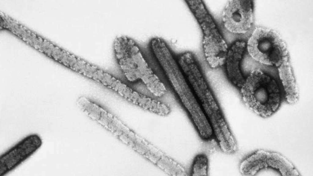 O virus de Marburgo visto desde un microscopio. (Foto: CDC)