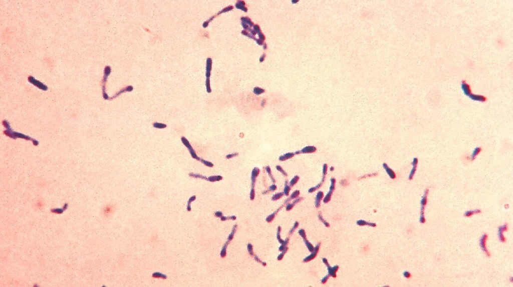 Imaxe a microscopio da bacteria da Dofteria (Foto: CDC).