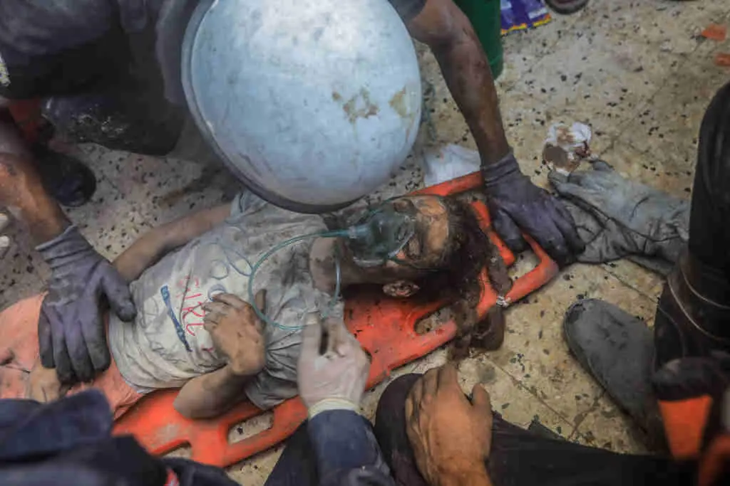 Nena ferida nun ataque israel&iacute; hoxe. (Foto: Mohammed Talatene / DPA)