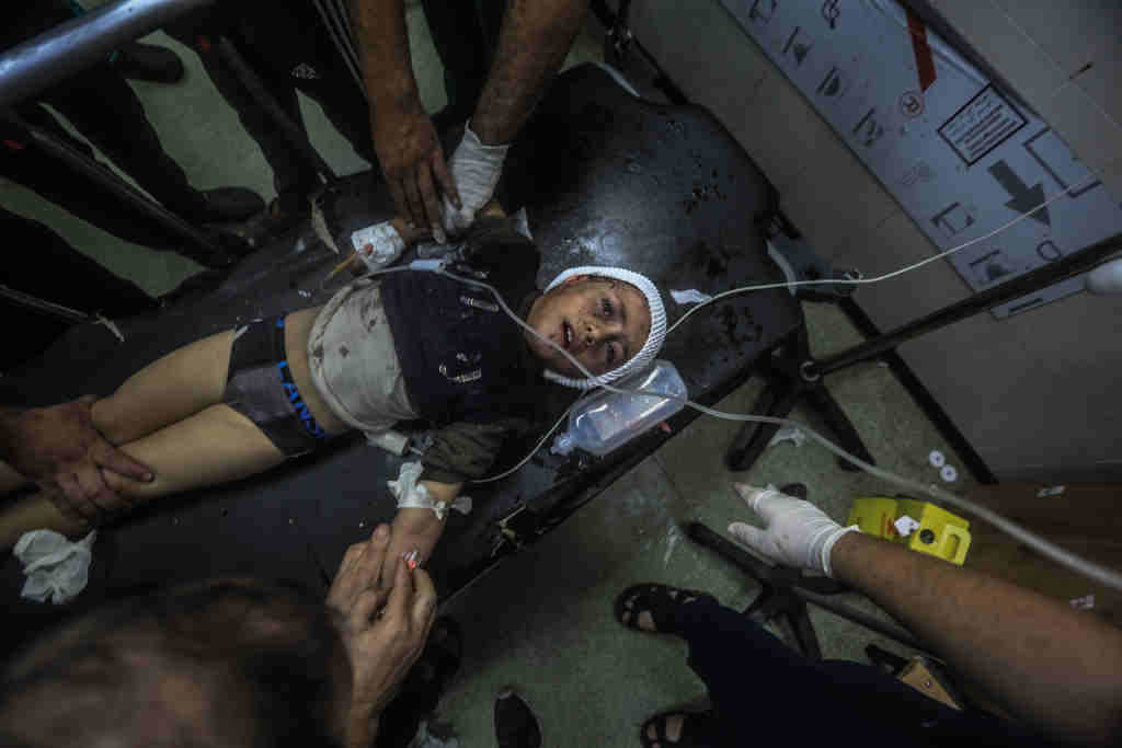 Crianza ferida nun bombardeo israelí no sur da Faixa de Gaza, Palestina. (Foto: Mohammed Talatene / DPA)