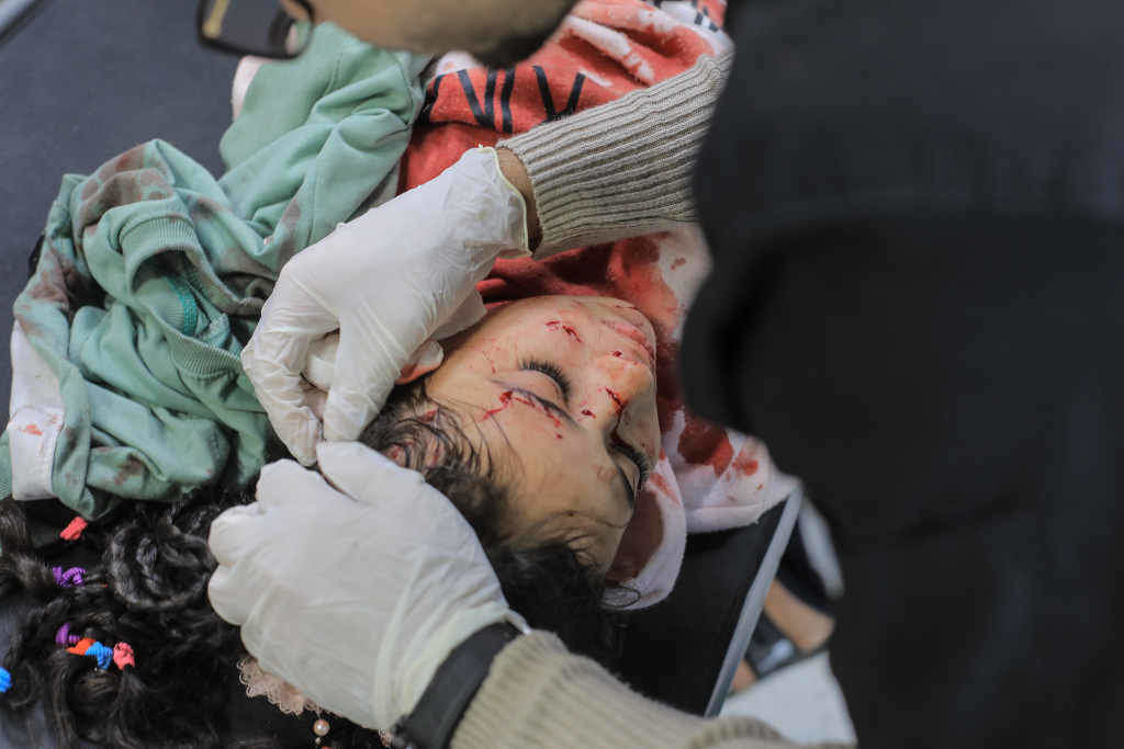 Crianza ferida por un bombardeo israelí a pasada sexta feira en Khan Younis, no sur da Faixa de Gaza. (Foto: Mohammed Talatene / DPA)