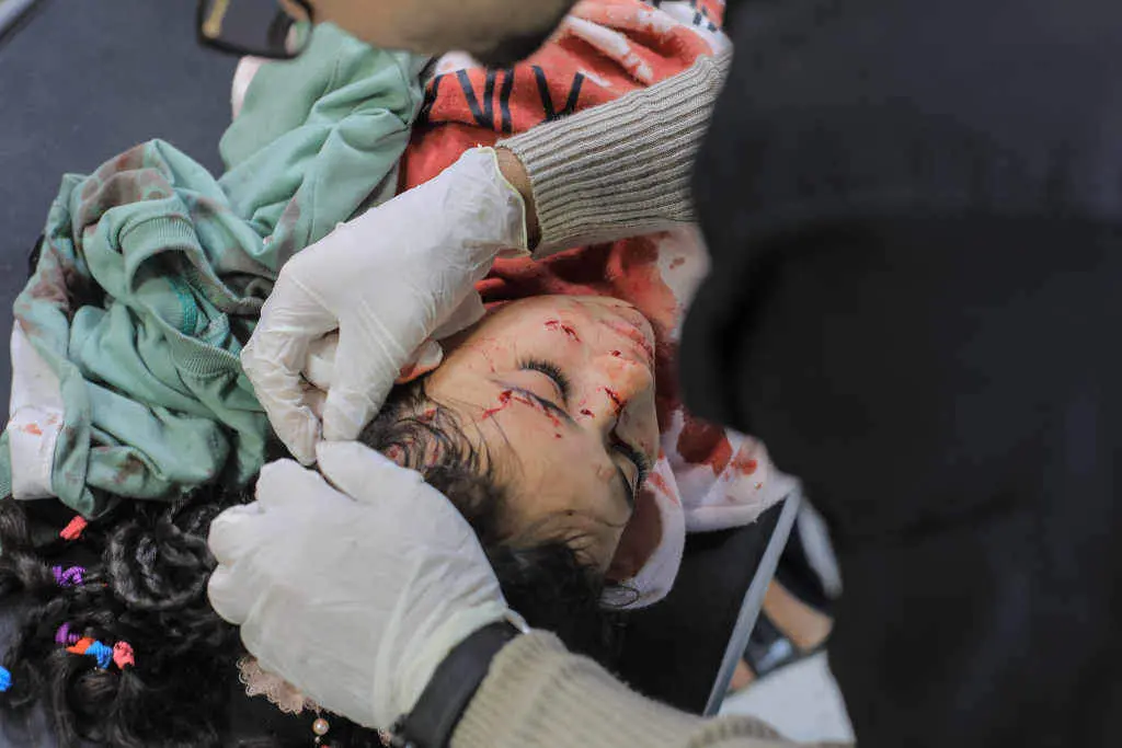 Crianza ferida por un bombardeo israel&iacute; a pasada sexta feira en Khan Younis, no sur da Faixa de Gaza. (Foto: Mohammed Talatene / DPA)