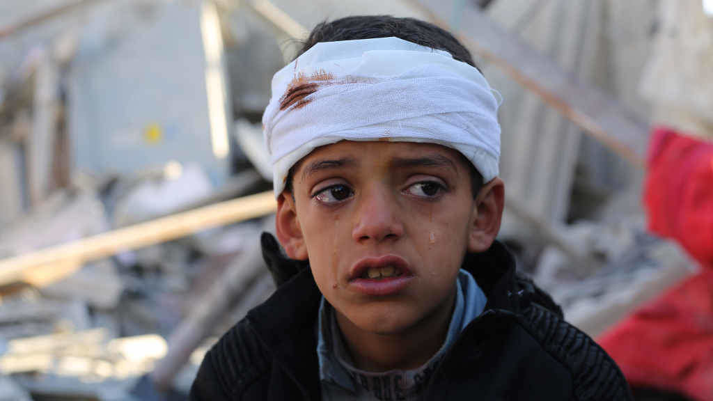Crianza ferida na Faixa de Gaza. (Foto: Khaled Omar / Xinhua News / Contactophoto)
