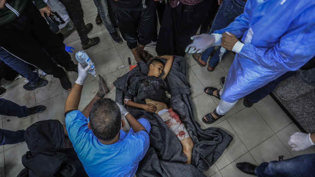 Ferido nun ataque israelí. (Foto: Mohammed Talatene / DPA)