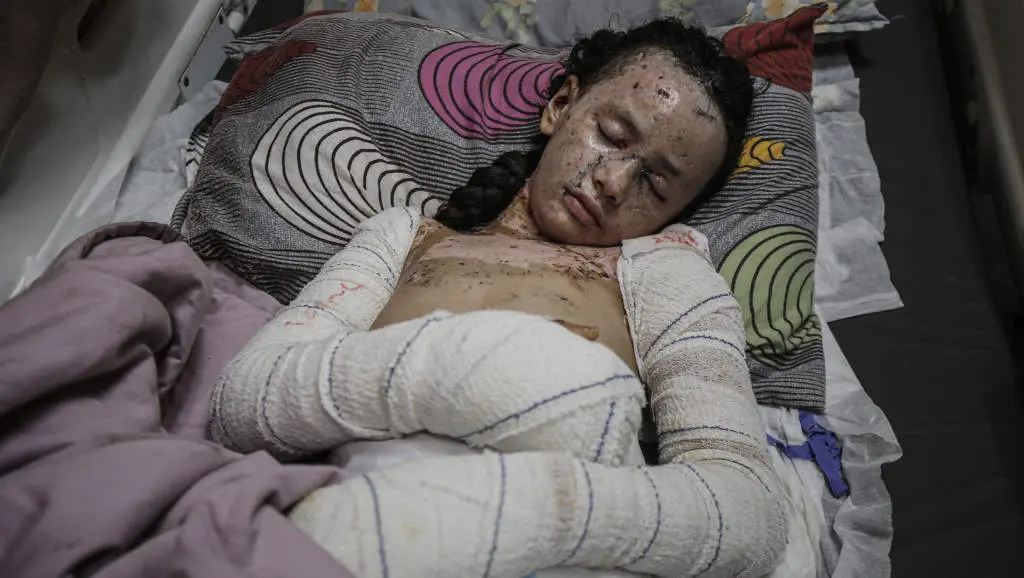 Crianza palestina ferida nun ataque israel&iacute; a Gaza. (Foto: Omar Ashtawy / APA Images via ZUMA / DPA v&iacute;a Europa Press)