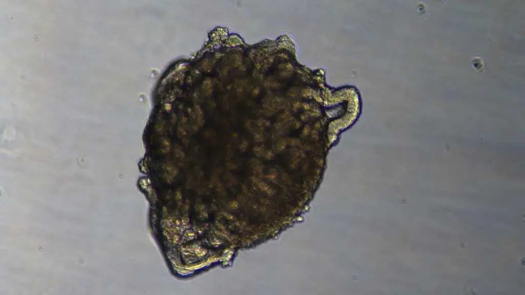 Imaxe de organoides. (Foto: IBEC)