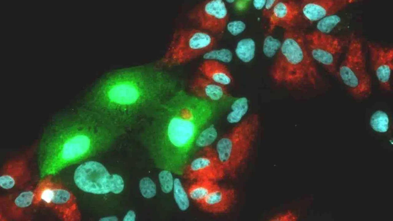 Imaxe tomada con microscopio do virus da hepatite. (Foto: Europa Press)