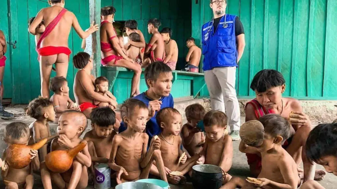 Crianzas yanomami en xaneiro con claras mostras de desnutrici&oacute;n. (Foto: Minist&eacute;rio da Sa&uacute;de do Brasil)