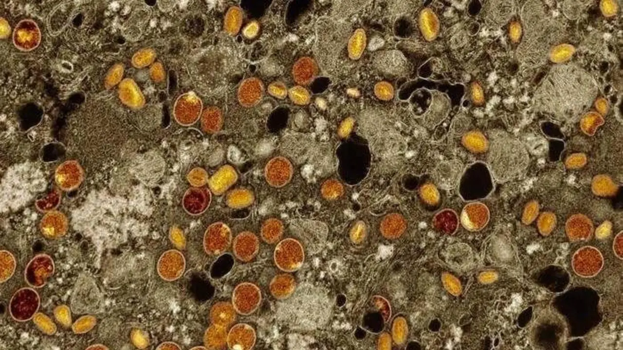 Imaxe de part&iacute;culas do virus mpox (en vermello e amarelo).