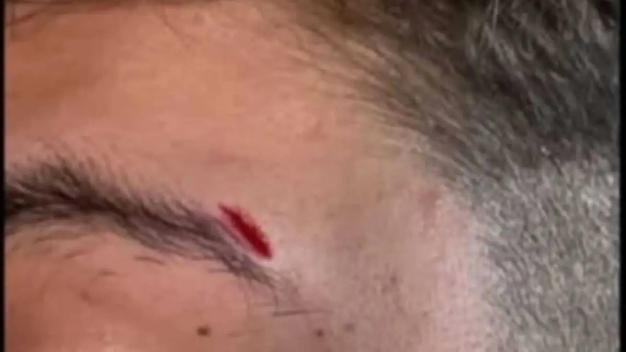 Corte que sufriu o mozo agredido. (Foto: N&oacute;s Diario)